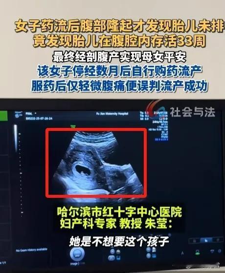 “这就是命！”哈尔滨一名 20 岁女子，不想要意外到来的孩子，就自己在家偷偷买了