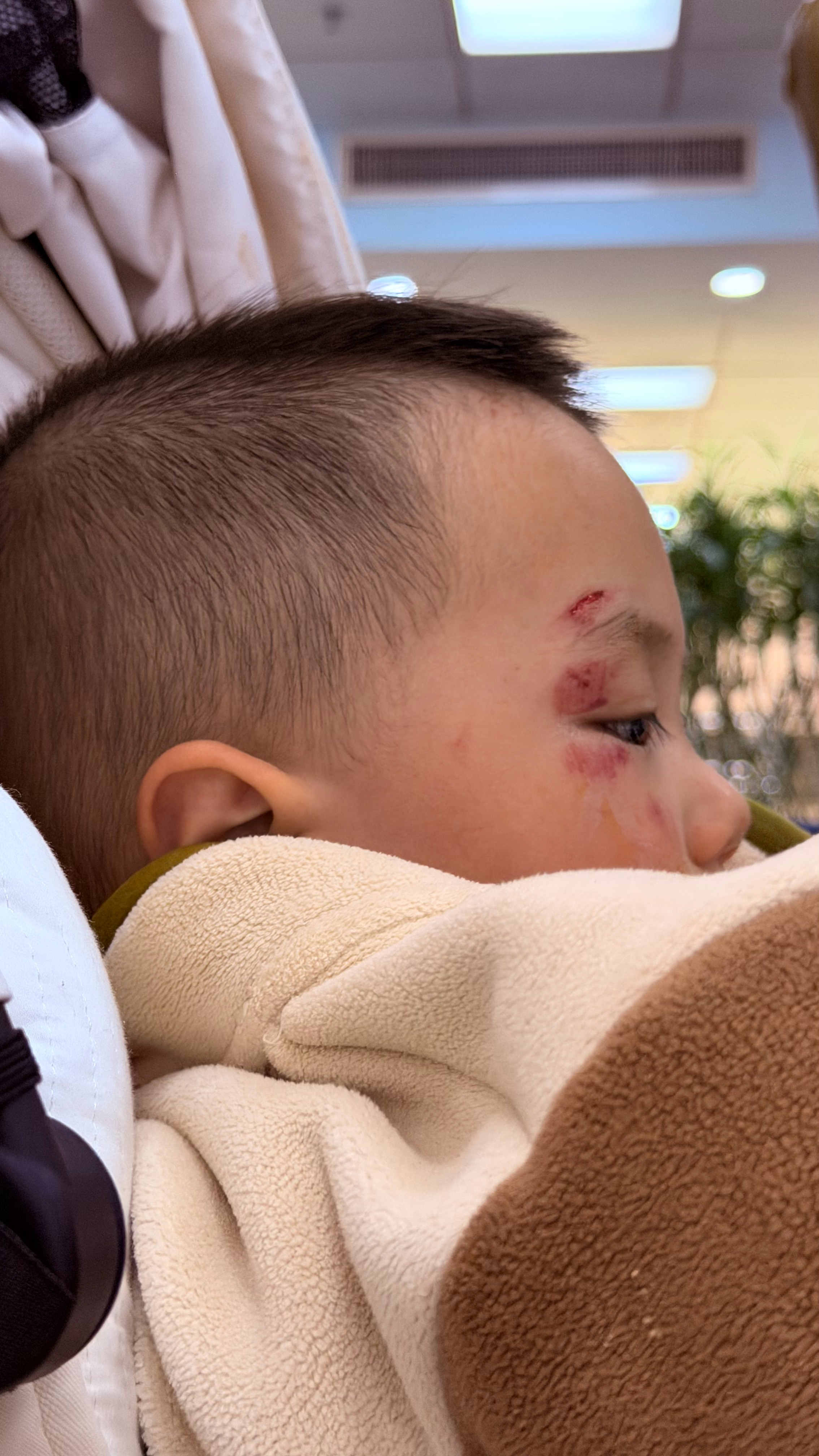 老人越老越像孩子！所以也要用对待孩子的心态对待他/她们！小崽子摔成这样也不敢说！