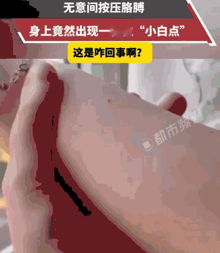 看着太瘆人！河南，一网友刚结束沐浴，热气蒸腾的浴室里，他无意间用手指按压了一下自