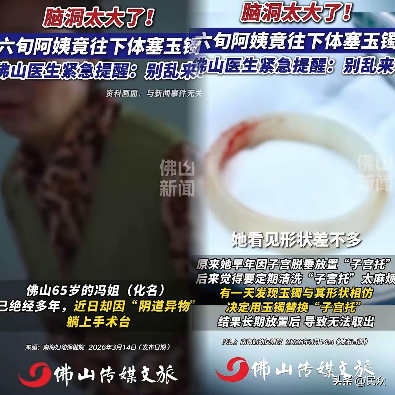 广东有位65岁阿姨就医原因是“阴道异物”，医生给她做了检查，发现异物竟然是一只玉