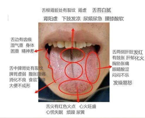 看舌就是健康 舌苔操作简单 全家适用 看懂疾病信号 避免大病或重病