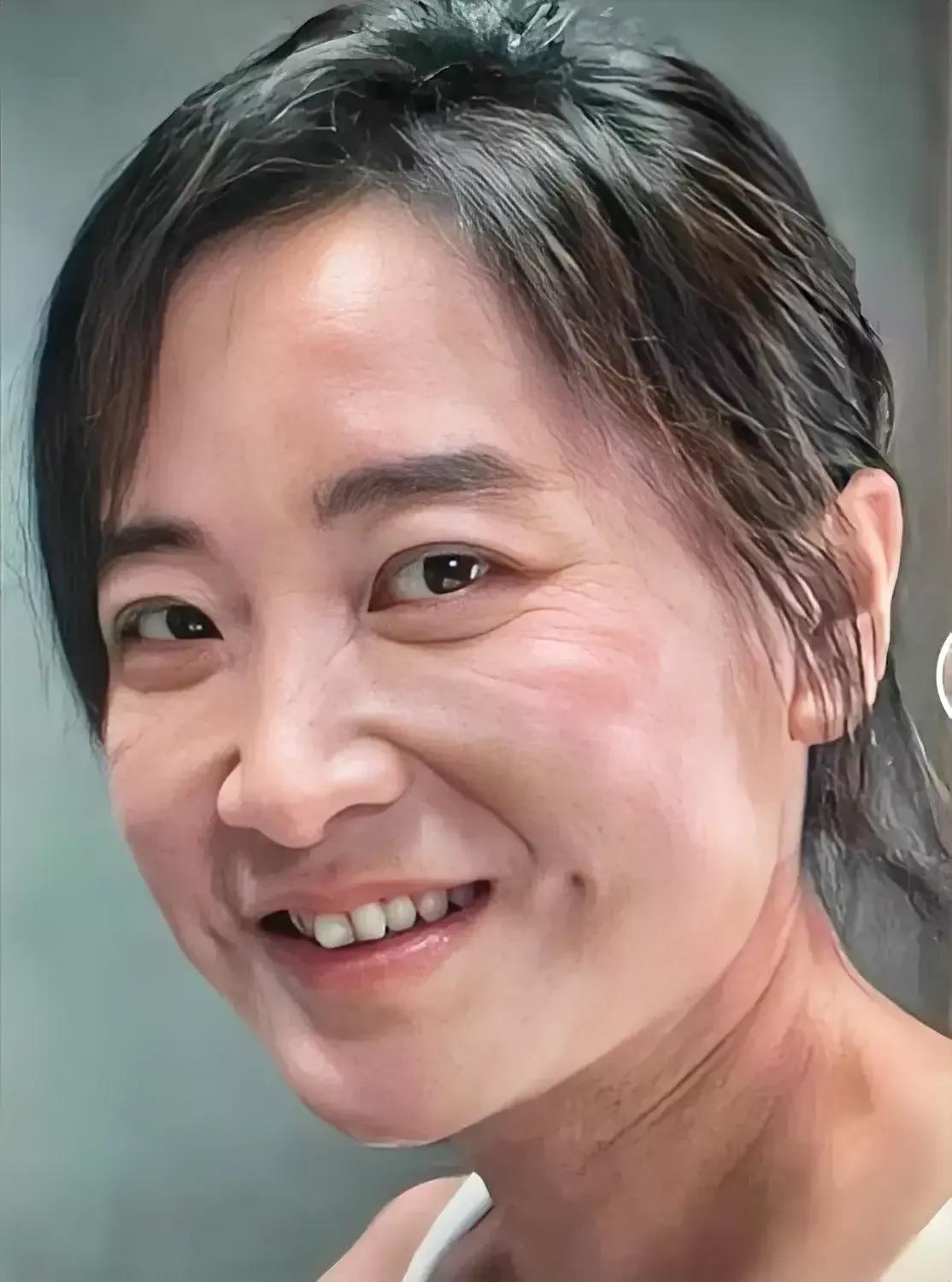 修复前的贾玲眼袋纹、眼尾纹异常明显，脸上的肉这一坨，那一坨，东一块西一块的，缺乏