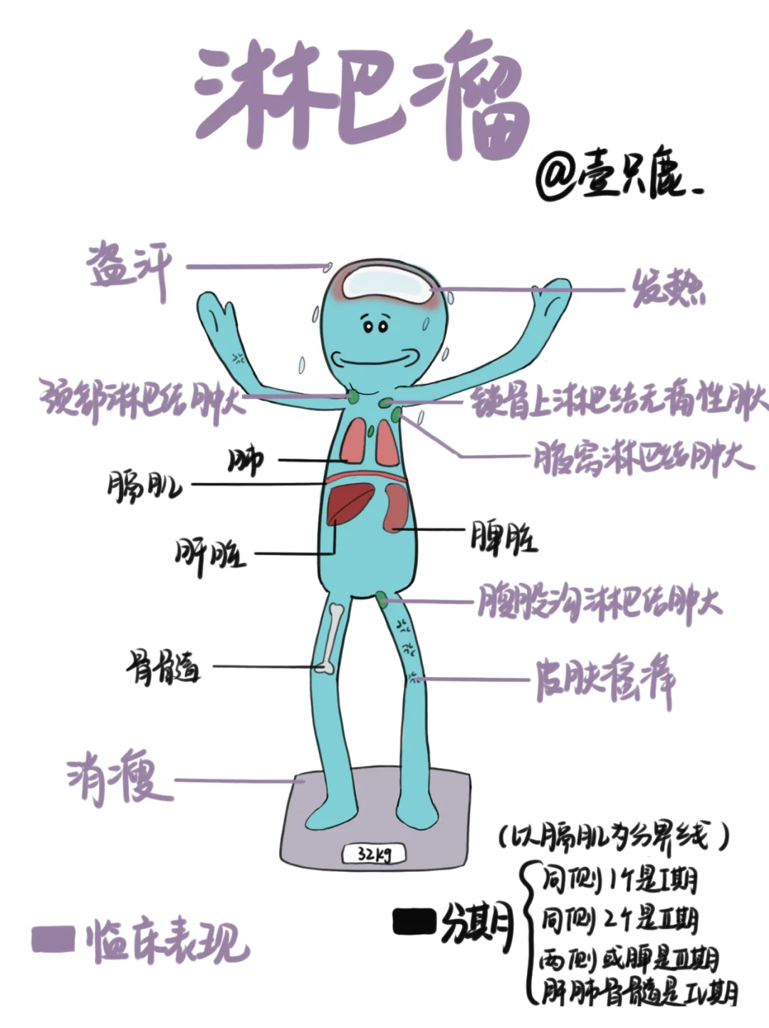 医学生笔记📒｜淋巴瘤🧐