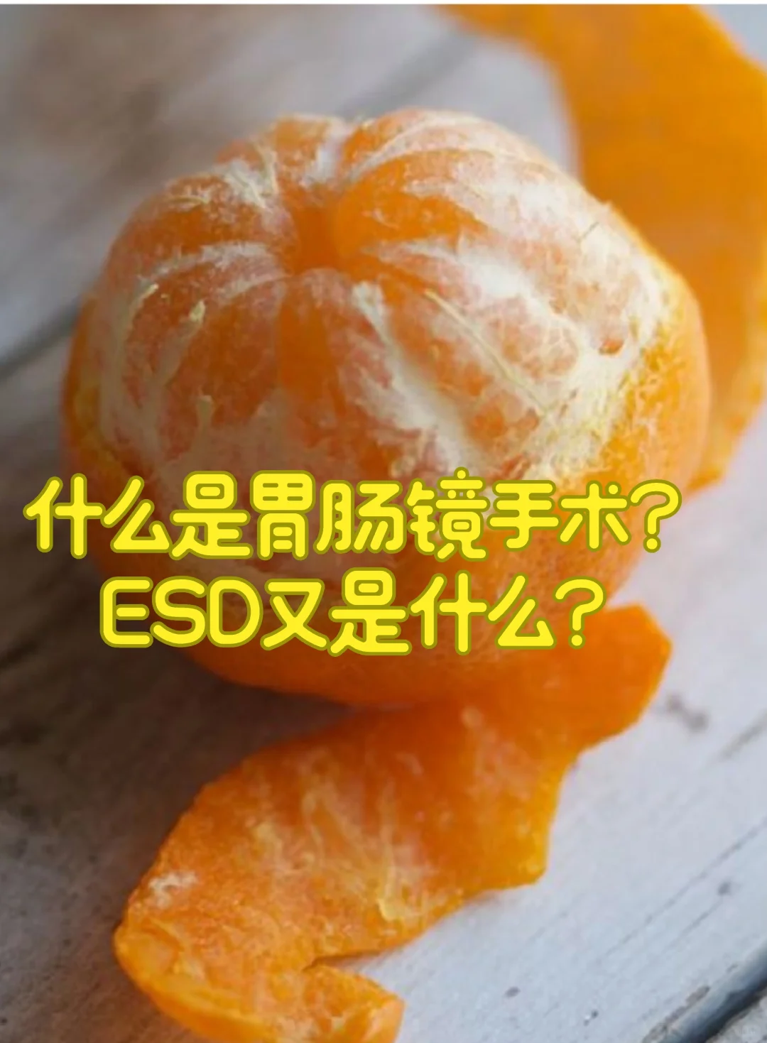 每一位内镜医生，都是剥🍊橘子的一把好手