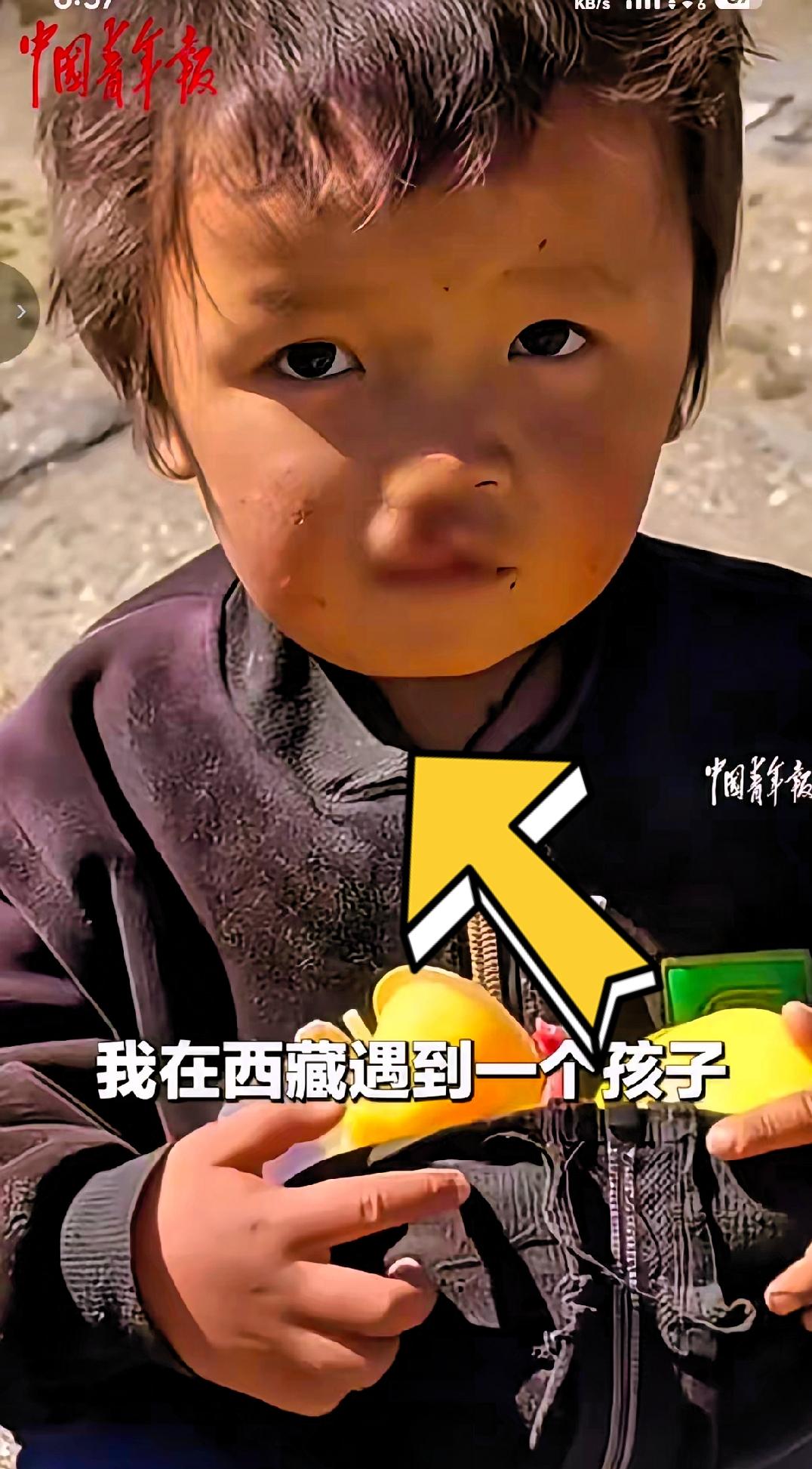 “积大德了!” 西藏日喀则，一名女子去旅行时，偶遇一位唇腭裂严重的男孩，他安静站