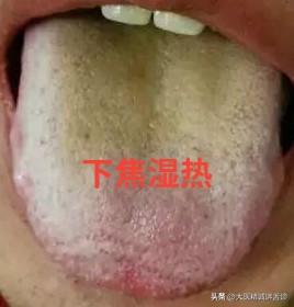 男人不行补哪里？中医一次性告诉你！

1.下焦湿热
表现：行事起不来，软弱无力，