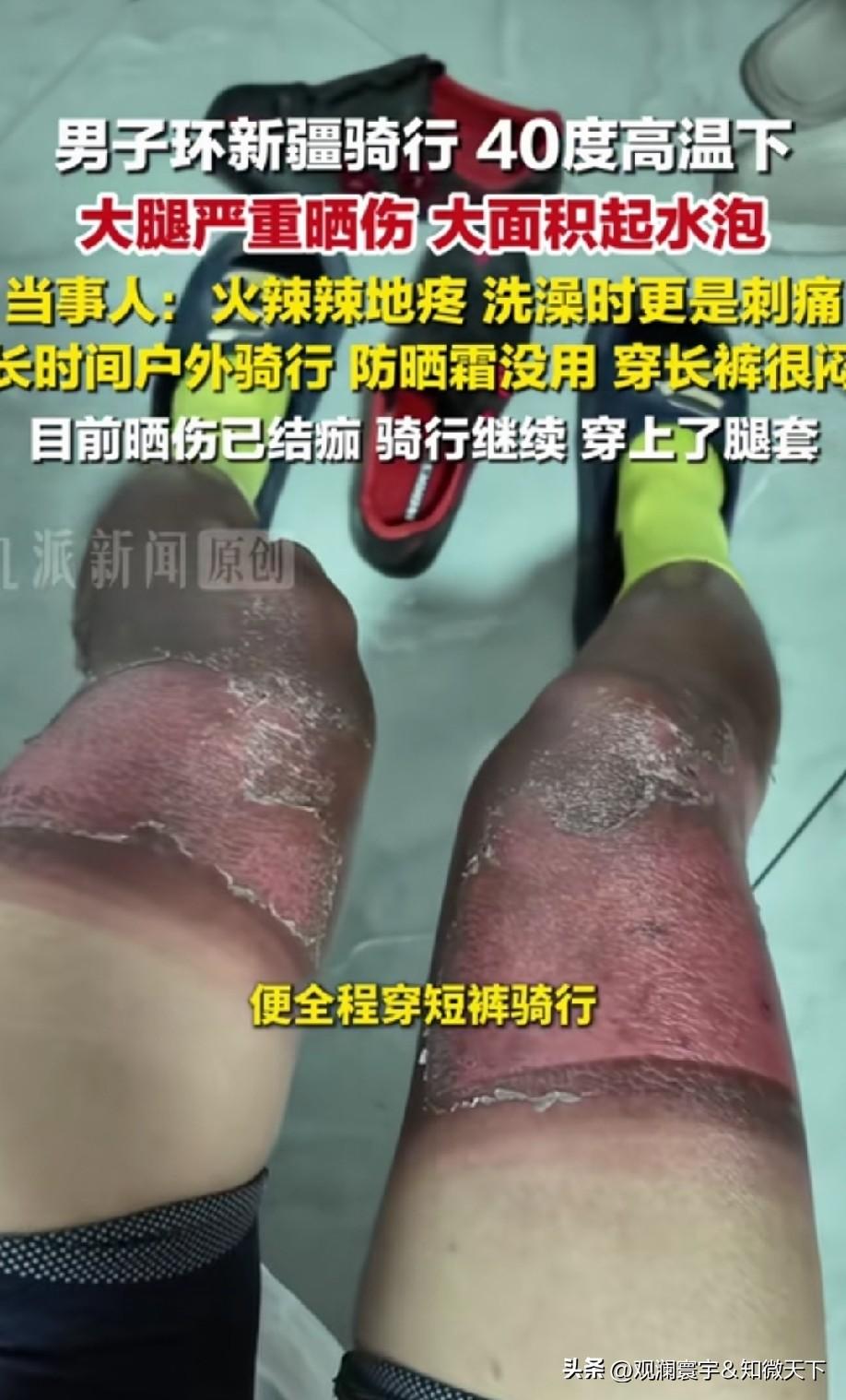 你这是有多爱骑行[捂脸]，这么热的天，还跑出去骑行！