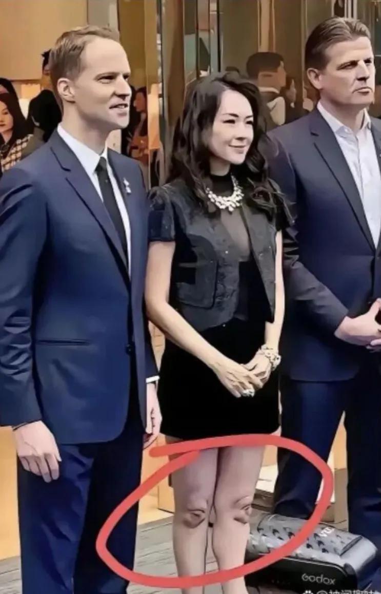 章子怡是经历了什么？膝盖成这种状态了！