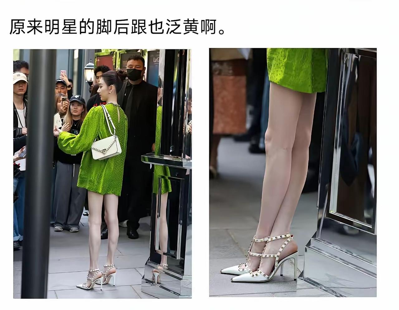 明星天天保养，脚后跟为什么也会泛黄呀