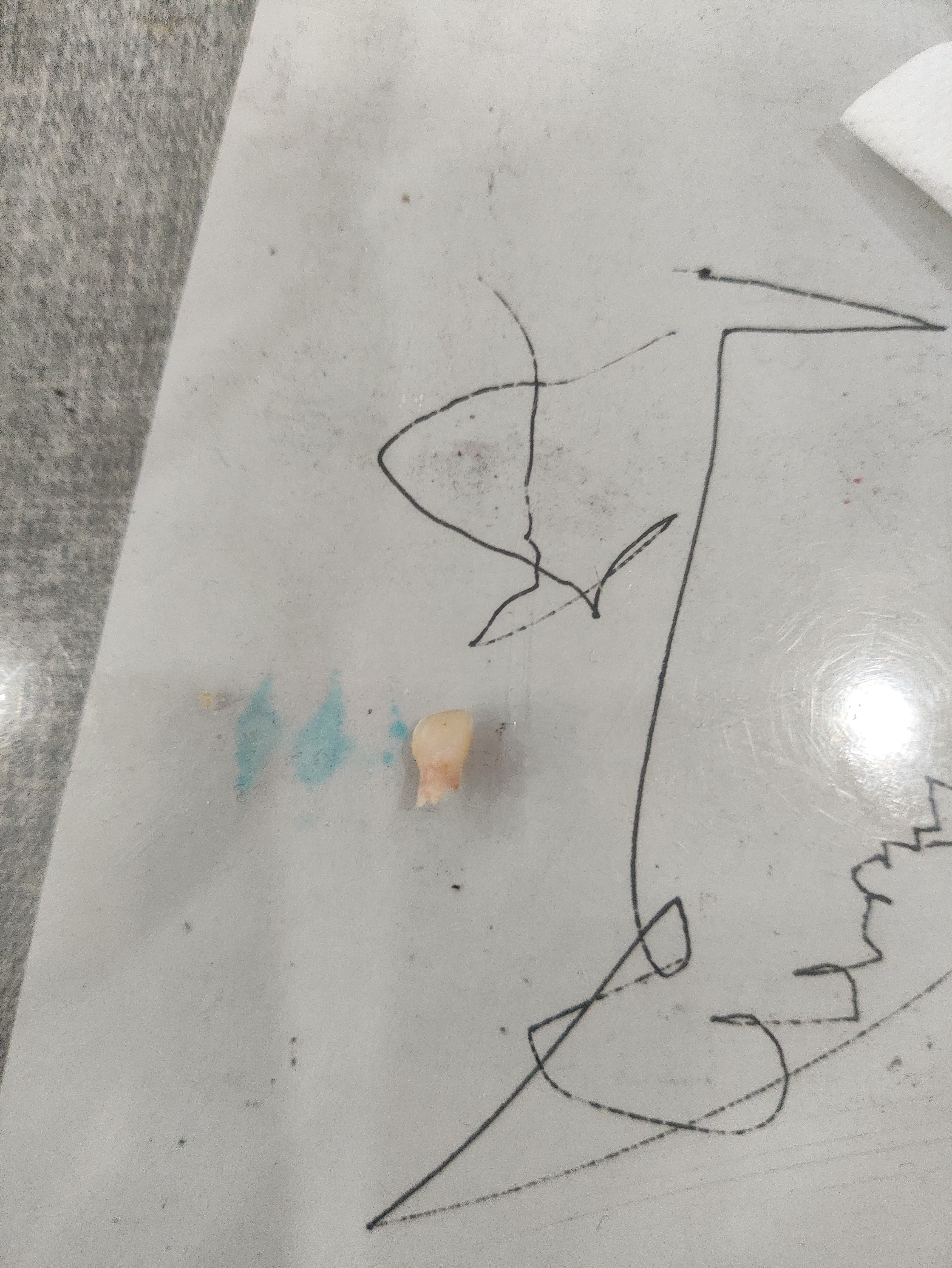 琦妙依 二姐又下一颗牙