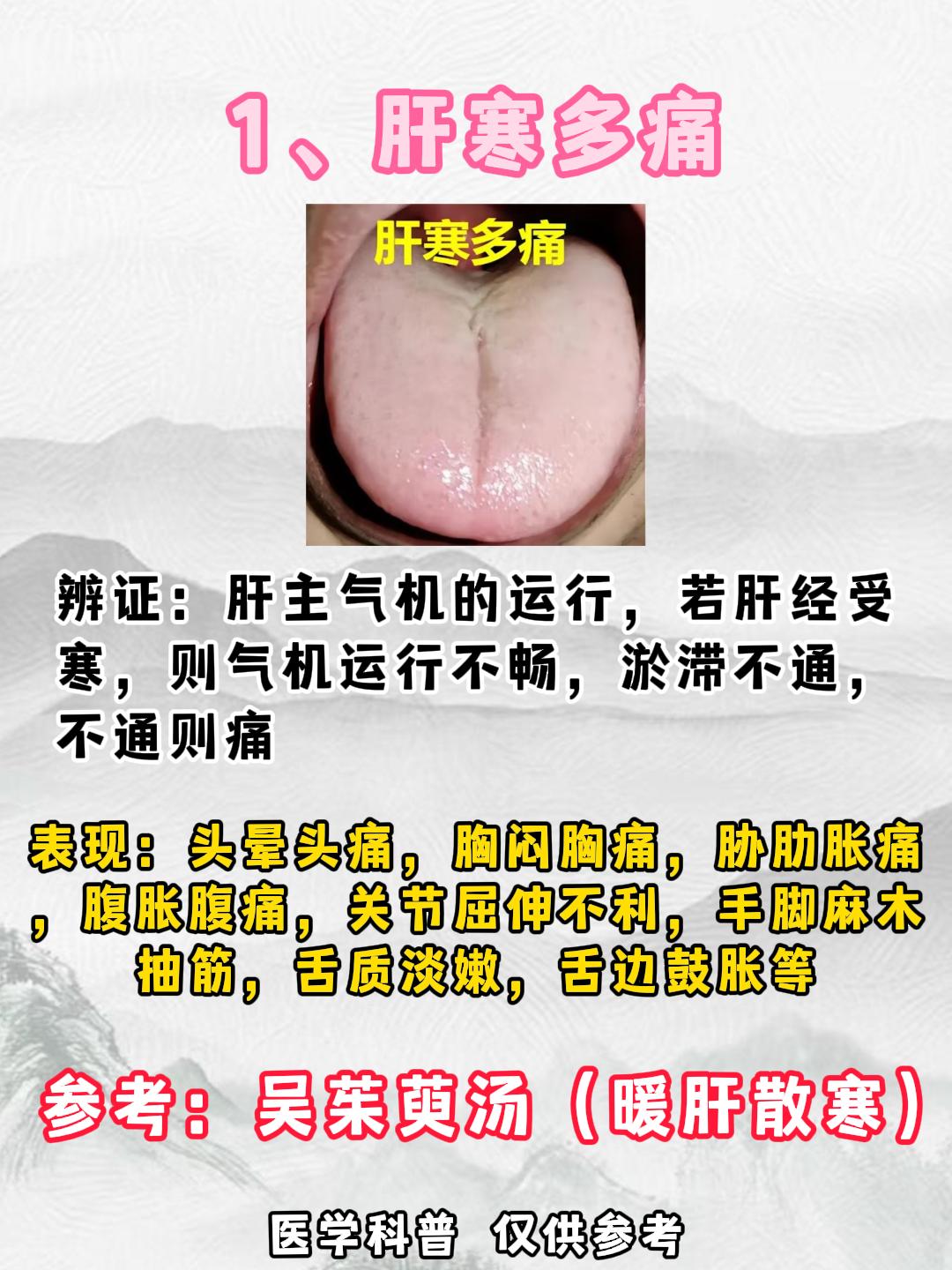 肝寒多痛、心寒多斑、脾寒多湿、肺寒多涕、肾寒多尿，一个药，祛一身寒！
#中医##