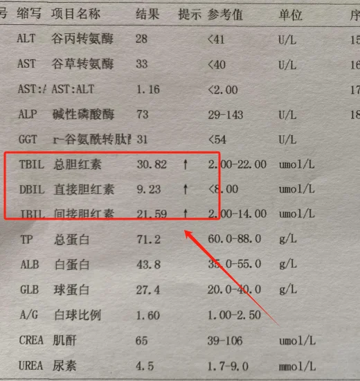 拿到这样的单子，千万别忽视！