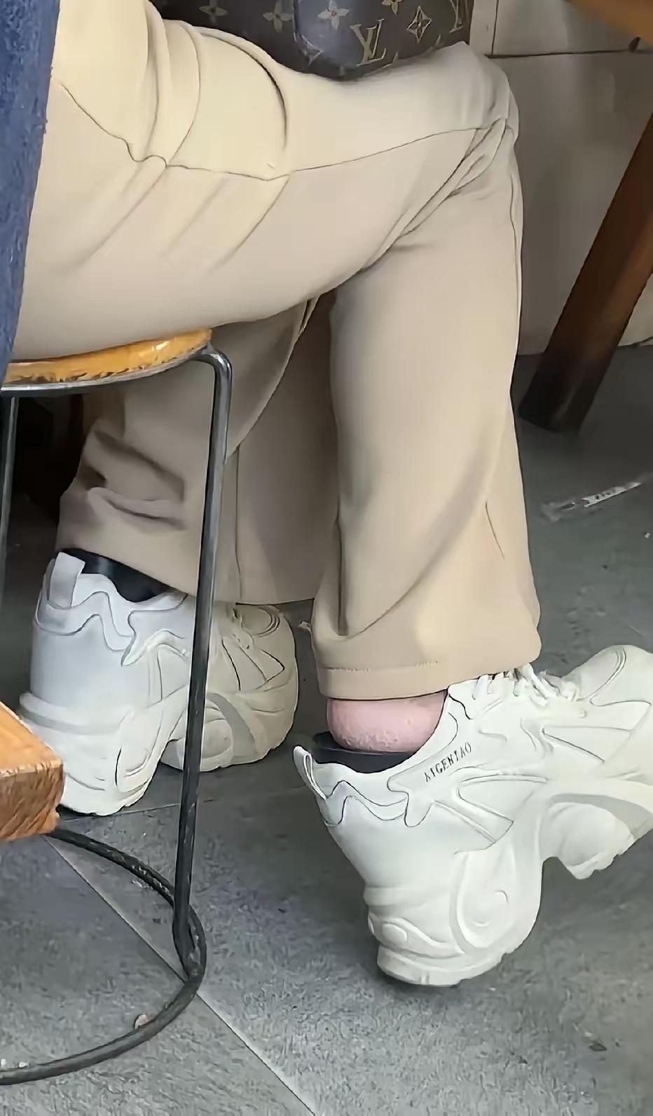 这是垫了多少个内增高啊，脚后跟露出来都秃噜皮了，这样穿好看吗？