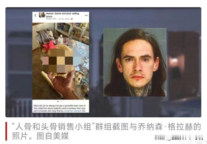 美国小伙居然售卖人类遗骸，想起来就让人觉得不寒而栗。据众多美媒报道称，近日，美国