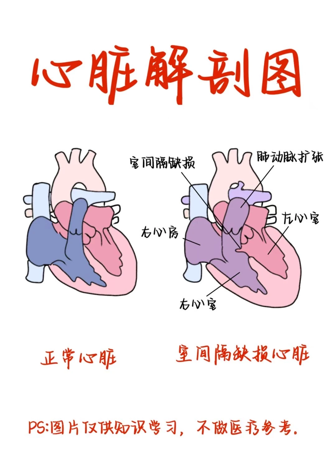 医学生笔记——心脏解剖图