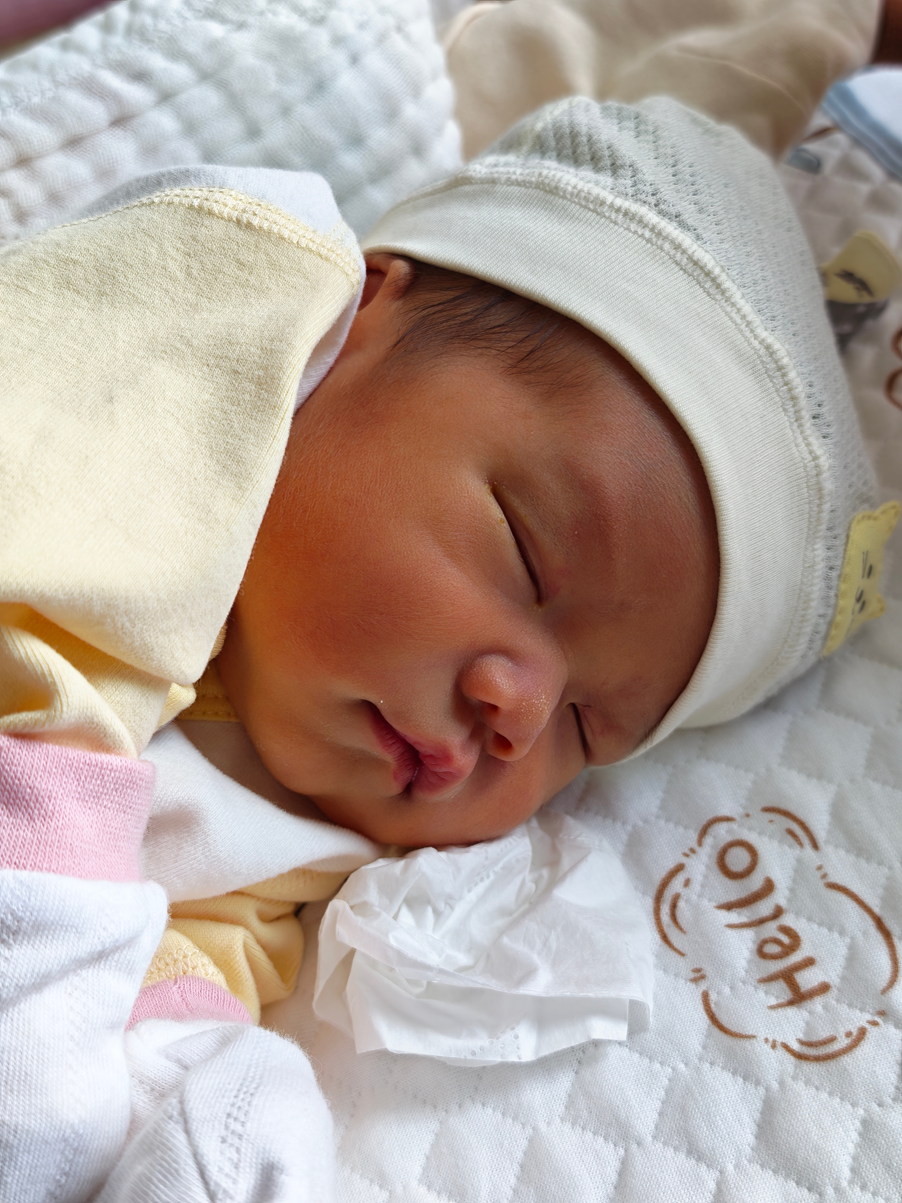 这小子昨天黄疸飙到 22 了…把我们都吓坏了，医生也说第一见黄疸飙这么高的，很少
