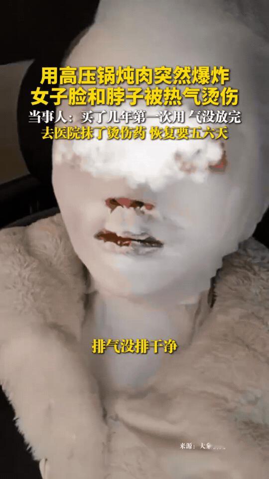 家人们，这事儿看着都疼！河北保定的张女士，用高压锅炖肉时突然发生爆炸，滚烫的热气