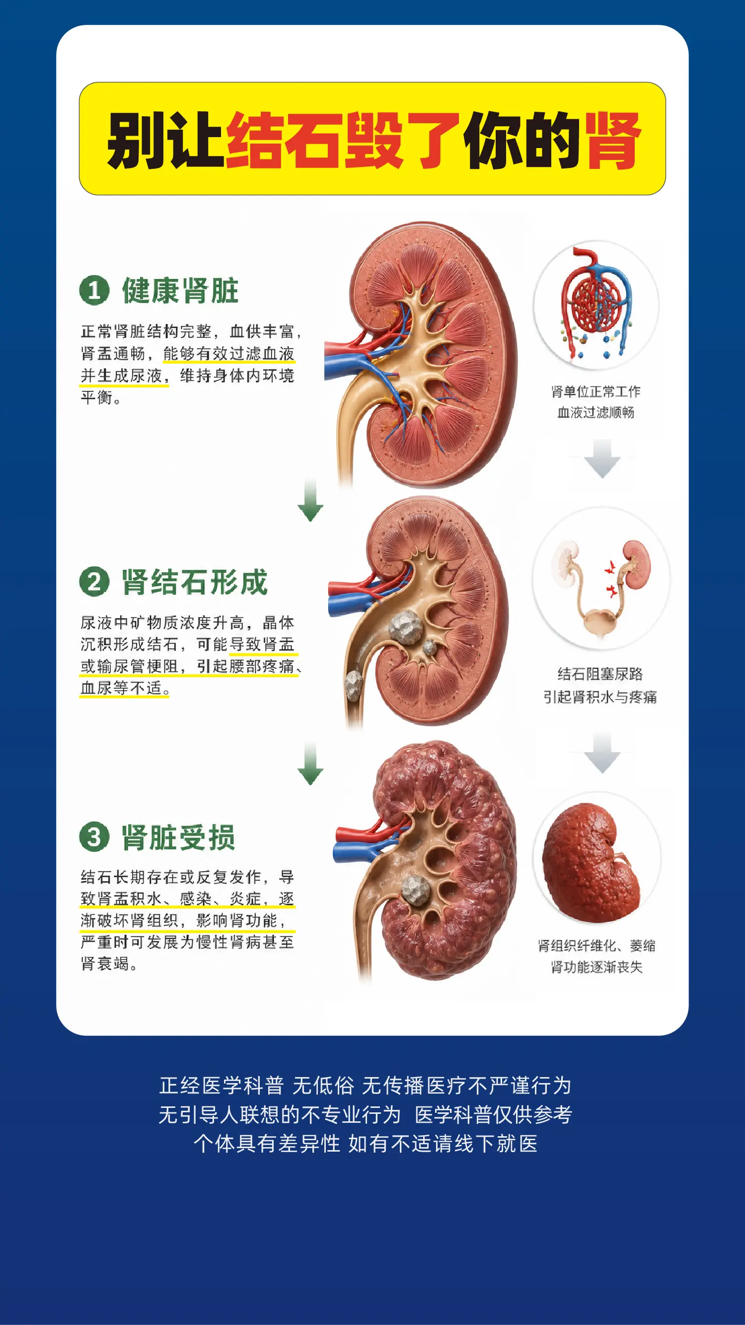 健康肾-受损肾，别让肾结石毁了你的肾。