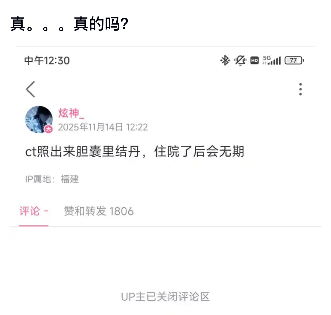 B站主播炫神胆囊结丹，住院后会无期。 