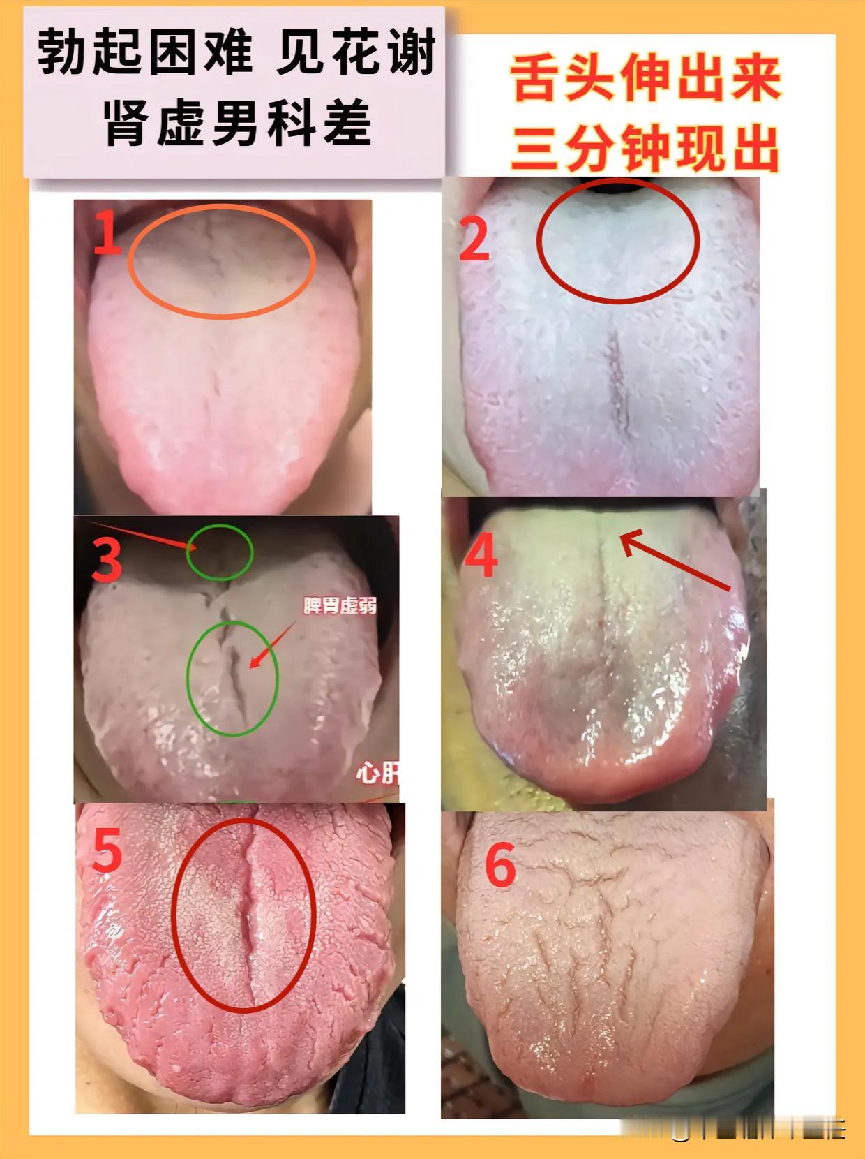 今天周六，空余时间多了，还是给大家看舌象！

只要你发，我就看，不会漏掉一个人的