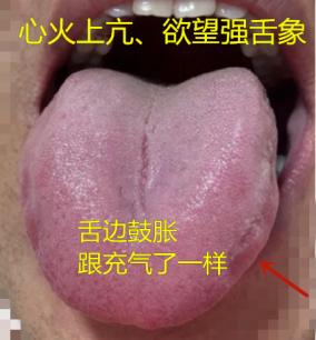 年龄大了，就别学年轻人放纵了，整天想那事，自己身体经得住吗！
 
患者情况：这位
