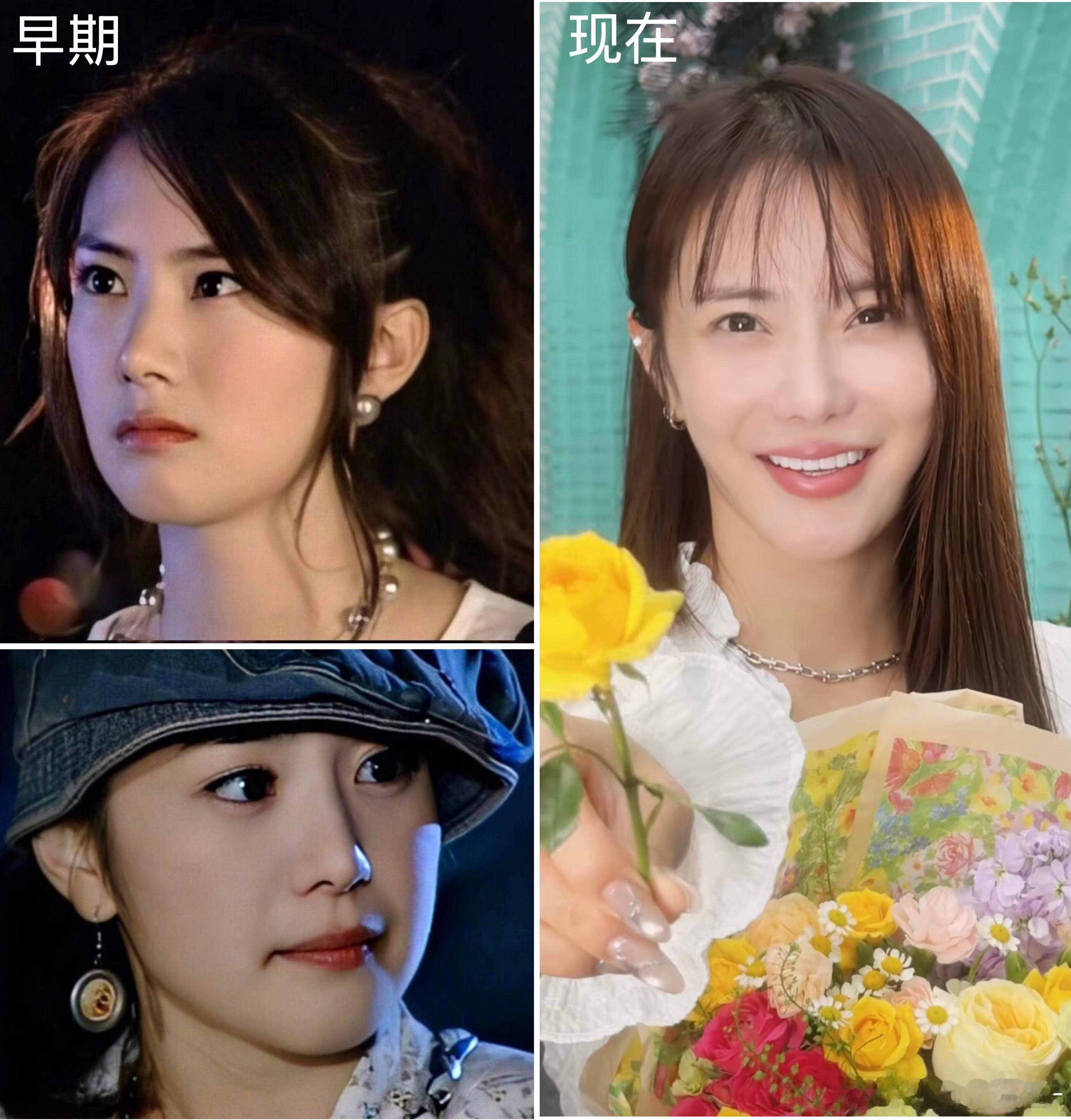 韩女明星医美后遗症开始显化了😬 