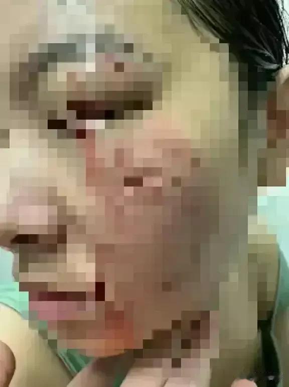 “松狮狗咬人事件”要告一段落了，被咬女子让步了，不再是网传的800万；狗主也松口