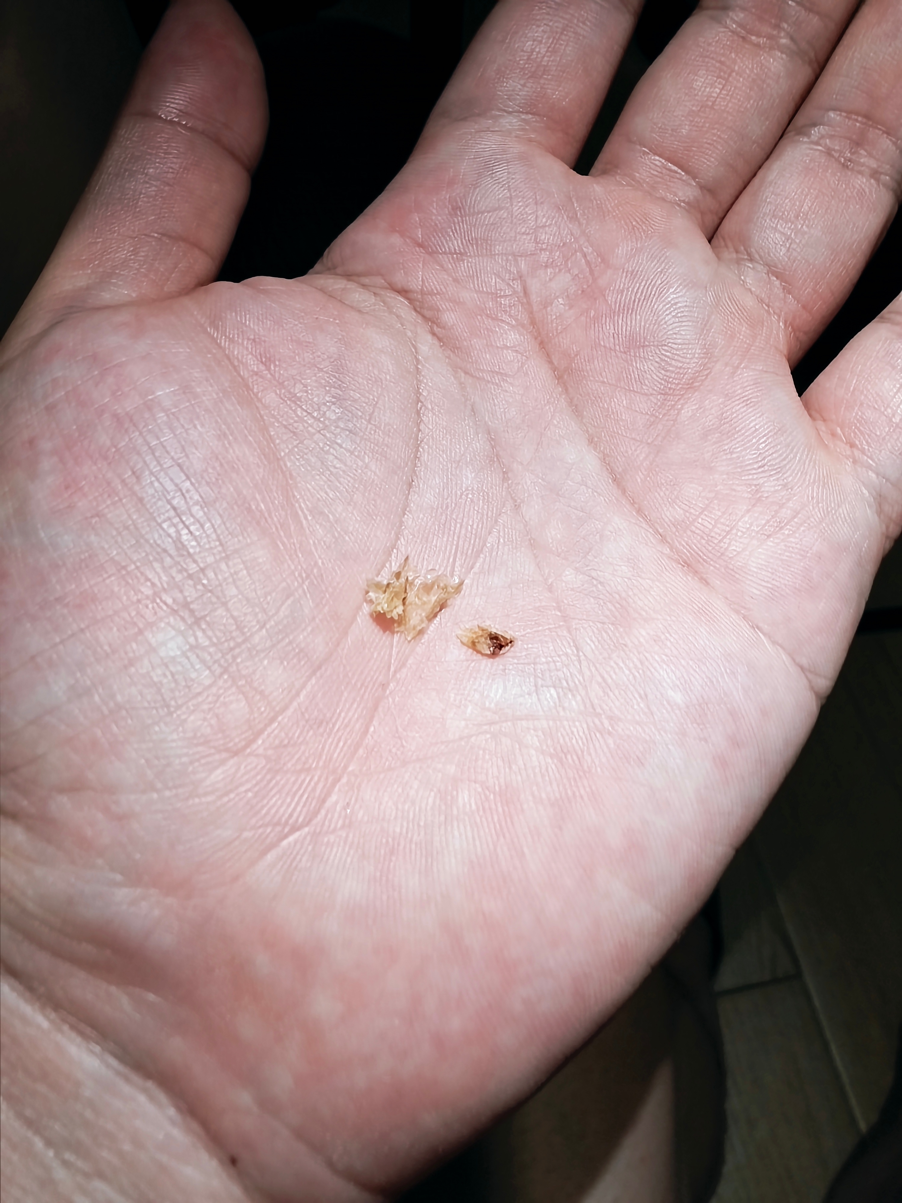 这个尺寸的耳屎称之为耳屎之王也不过分吧？ ​​​