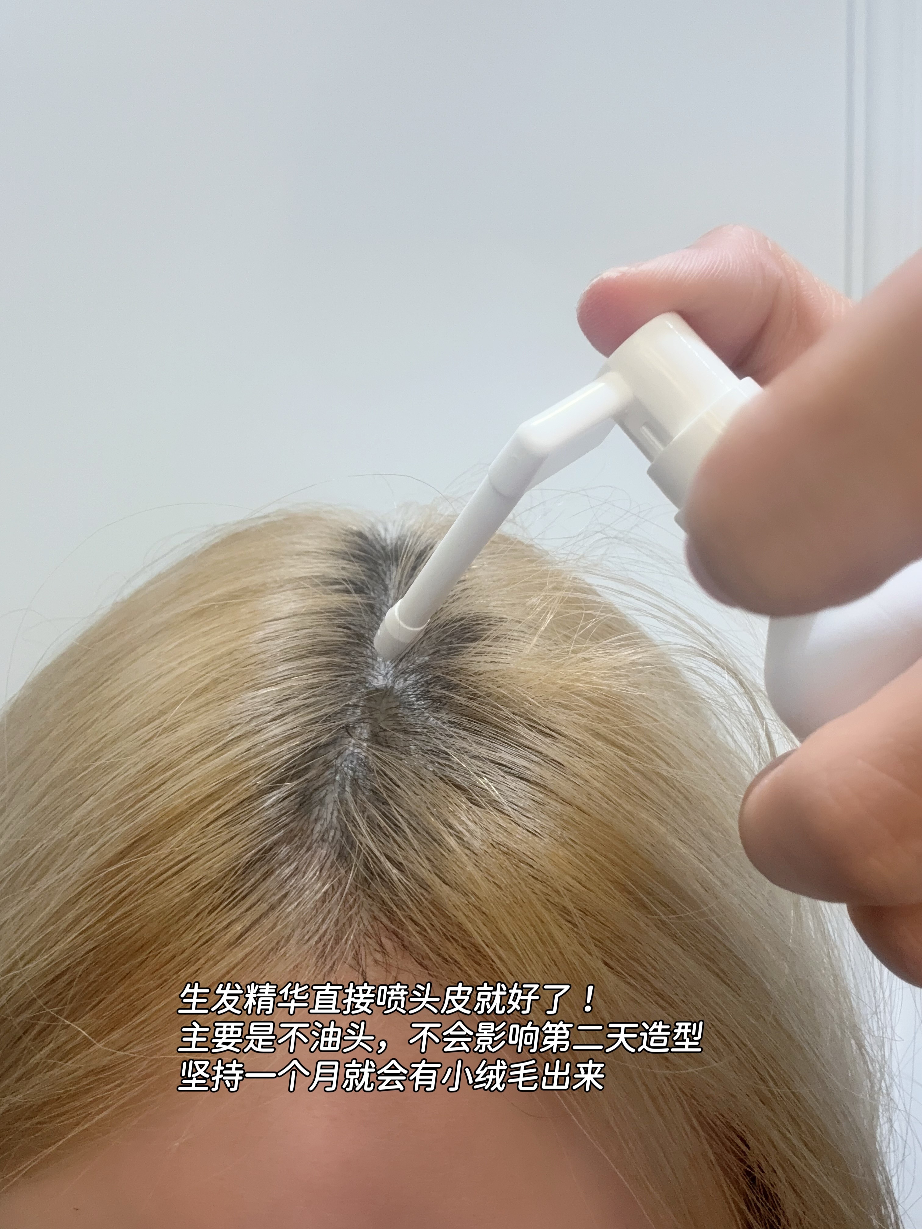 拜耳生发套餐🚗开咯！老规矩：评论区揪2️⃣个闺蜜晒单免单，👍🏻➕🍎揪1️
