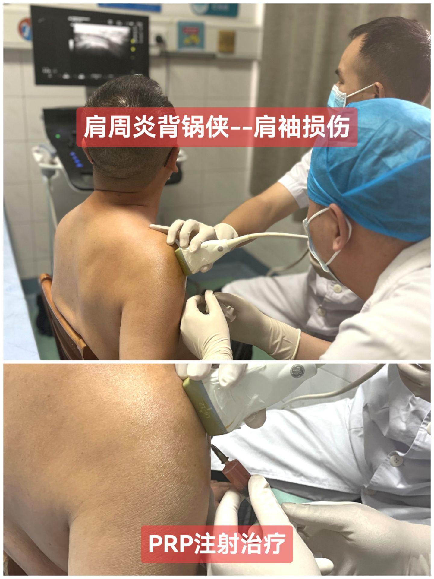 大部分中老年人的肩痛伴活动受限，民间都喜欢一口价“肩周炎”，其实很可能...