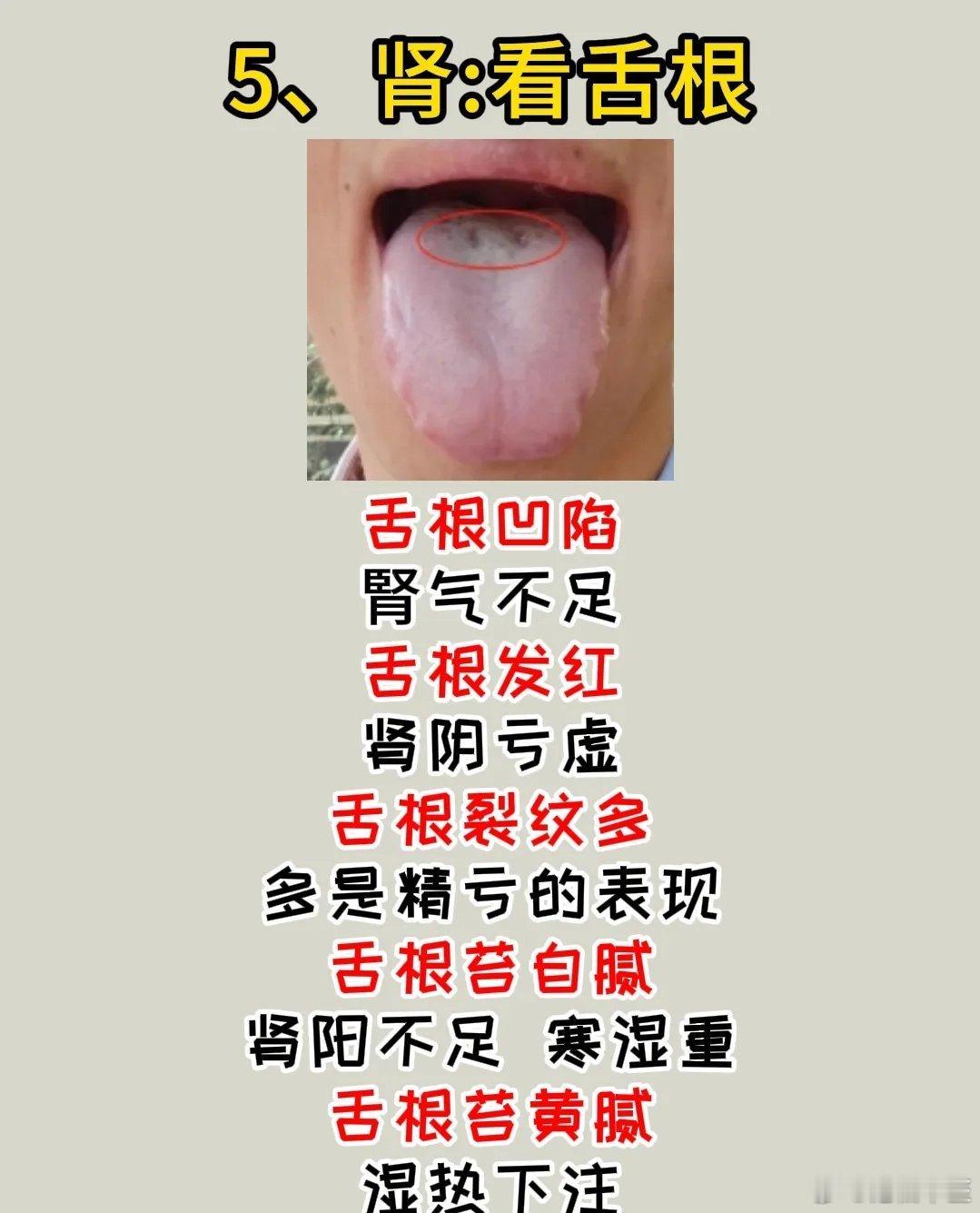 中医舌诊：1、心脏不好：看舌尖部；2、肝脏不好：看舌两边；3、脾脏不好：看舌中间