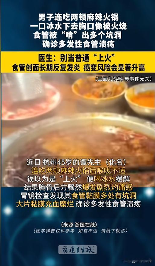 “看着就遭罪！”近日，浙江杭州，一男子接连吃了两顿麻辣火锅，当时是吃爽了，但是后