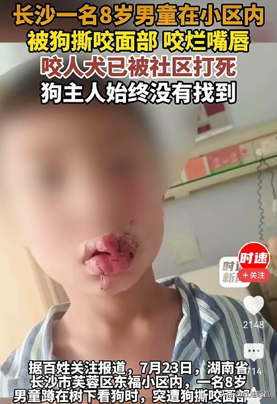 长沙一小区发生了恶犬咬伤8岁孩子的事件，各方的反应真是让人无语！
针对此事，社区