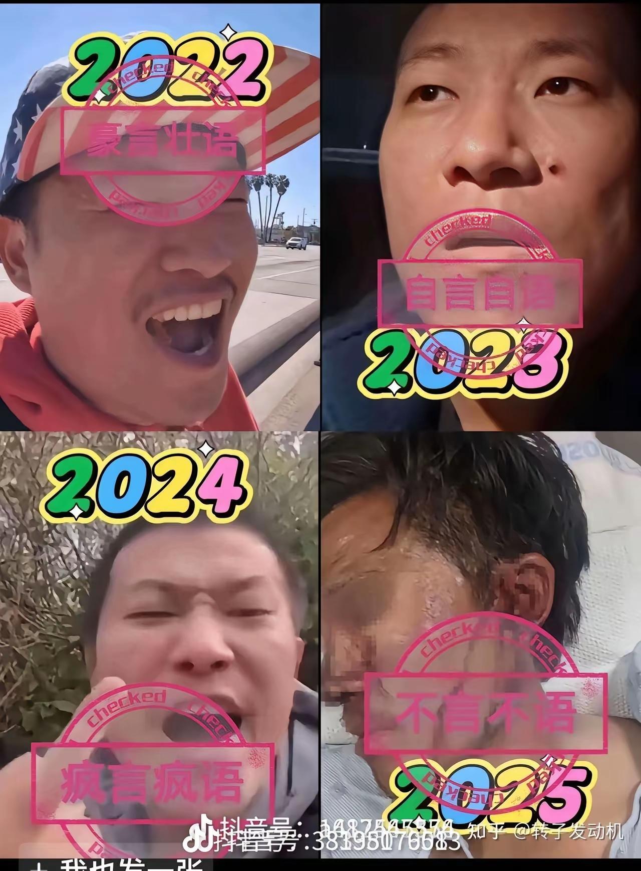 为什么美国那么多移民偷渡，但人口不增加？腰疼去医院看了看，而且没有任何检查，就医