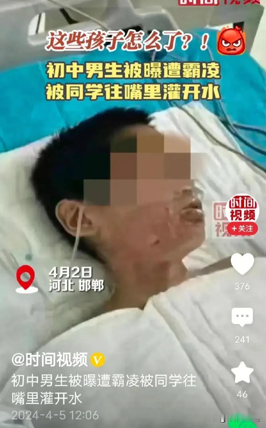 痛心！邯郸又曝初中生被霸凌事件，几个孩子往一个孩子嘴里灌开水？官方通报

近日，