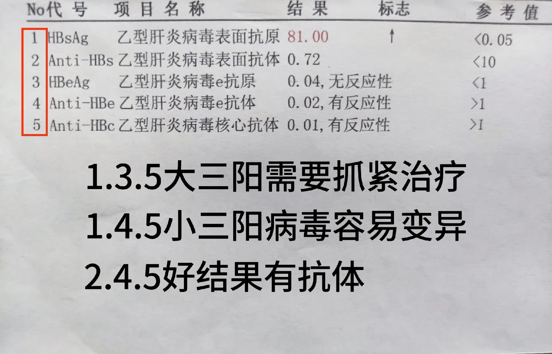 乙肝五项怎么看？ 1、3、5项阳性是“大三阳”，意味着乙肝病毒复制活跃...