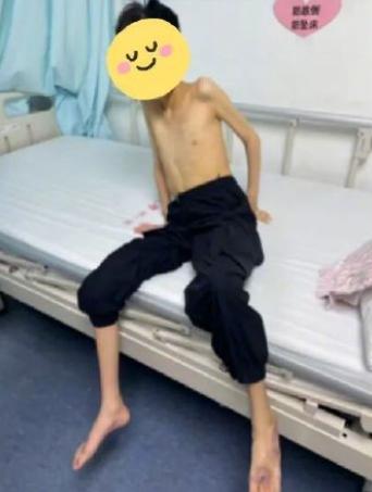 悲剧，还是没能避免。江西一名17岁少年，六年里反复呕吐、几乎吃不下任何东西，身高