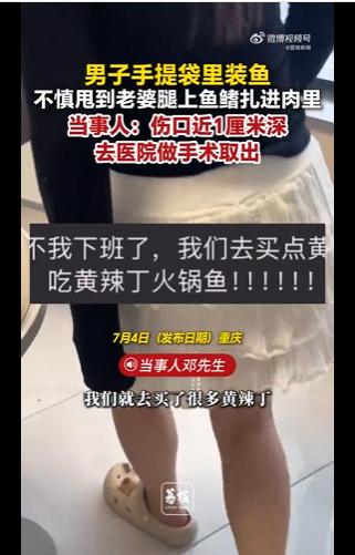 买鱼一不小心把鱼鳍扎进妻子肉里 近日，重庆的邓先生下班买鱼没处理直接拎回家，路上