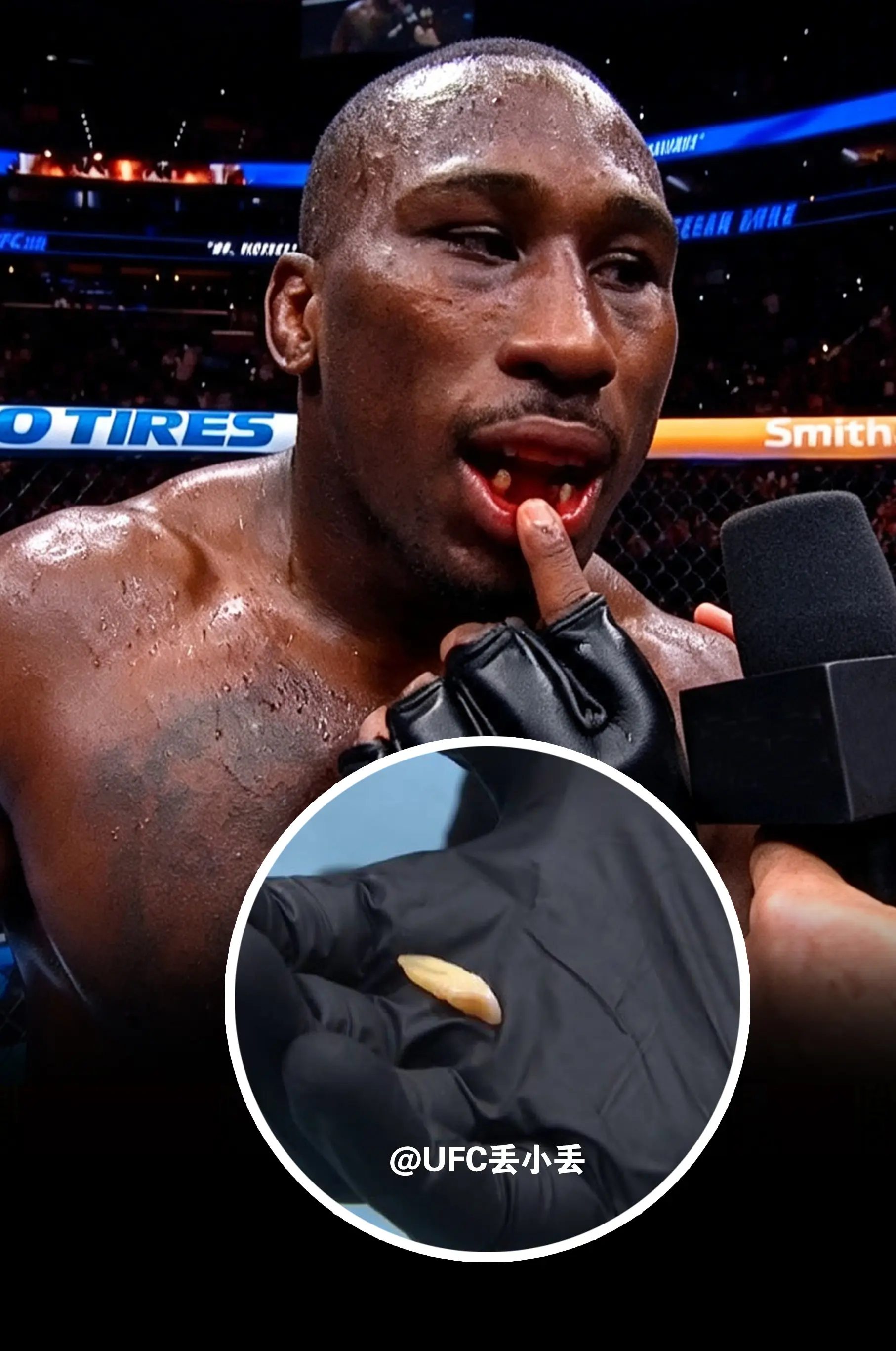 UFC330。这兄弟赢了比赛，可惜掉了一颗牙！可想ufc的强度有多高！