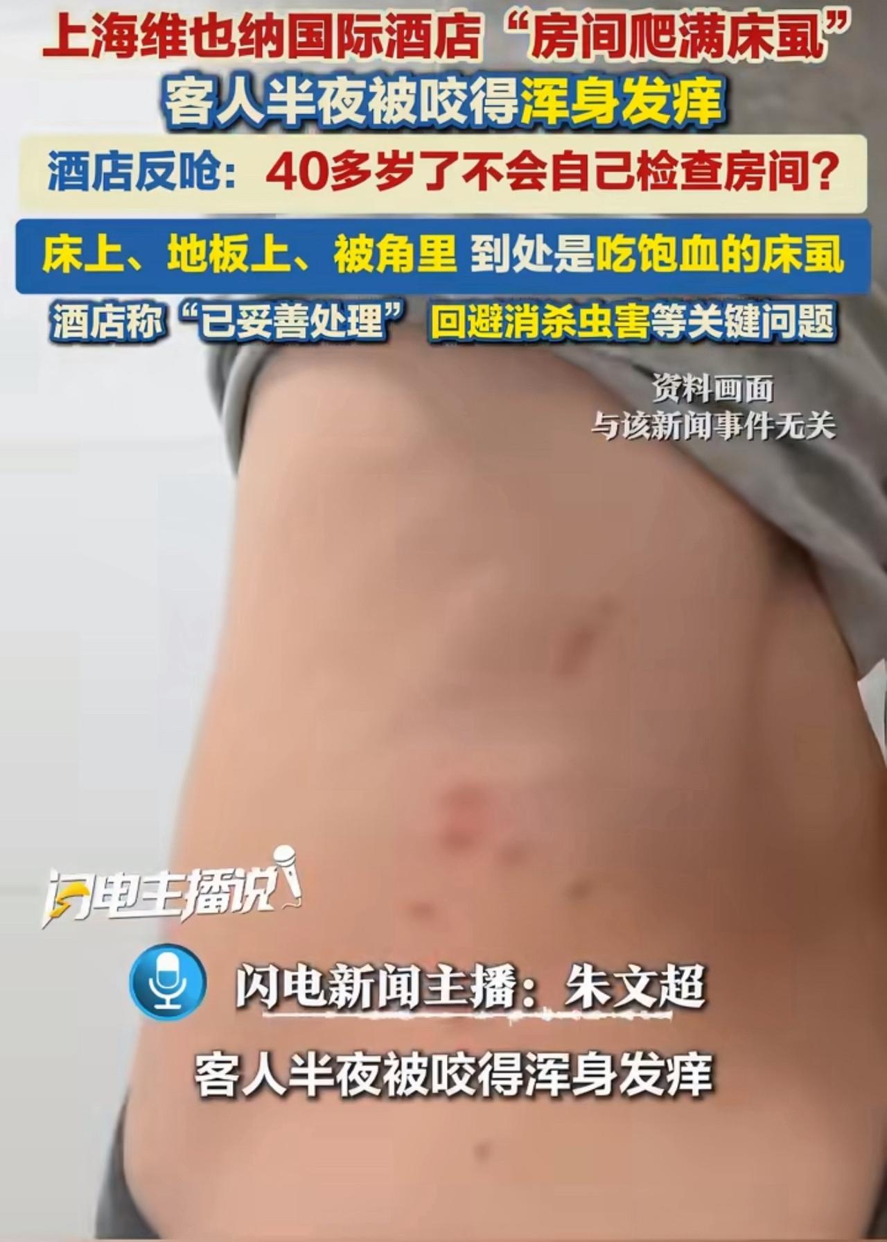 2026年7月28日晚，邓先生入住维也纳国际酒店青浦路店，躺下十分钟就浑身痒，开