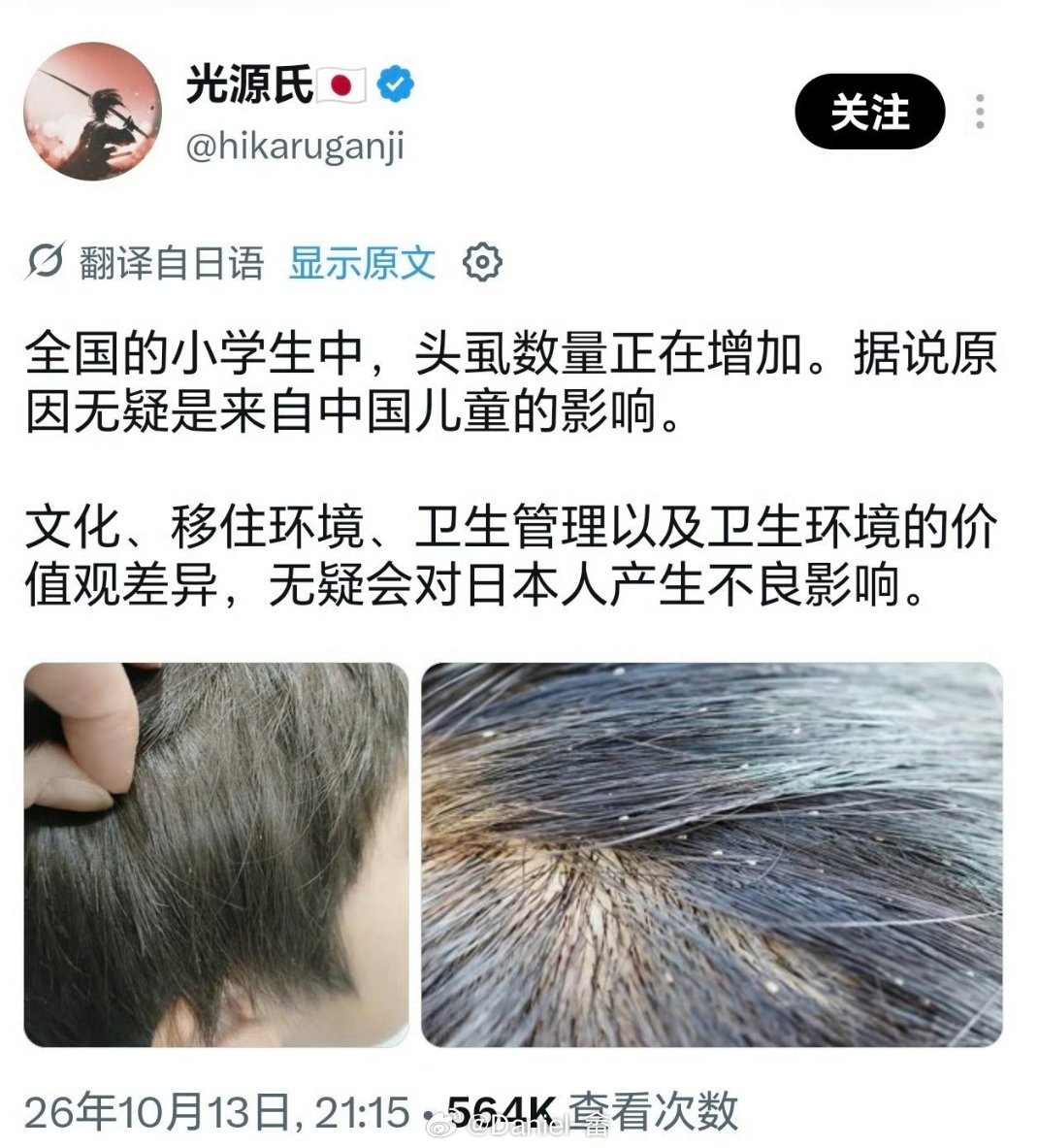 国内多久没见过这个了？ ​​​