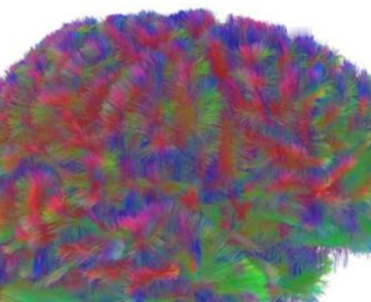 颠覆认知！人脑4个关键转折期敲定，9/32/66/83岁见证五段“进化史”
 