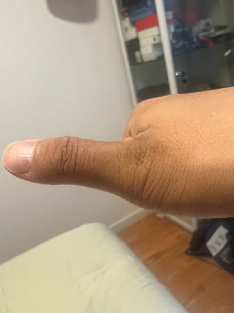 草原王的后劲很大  就露个拇指  已经晒分层了 