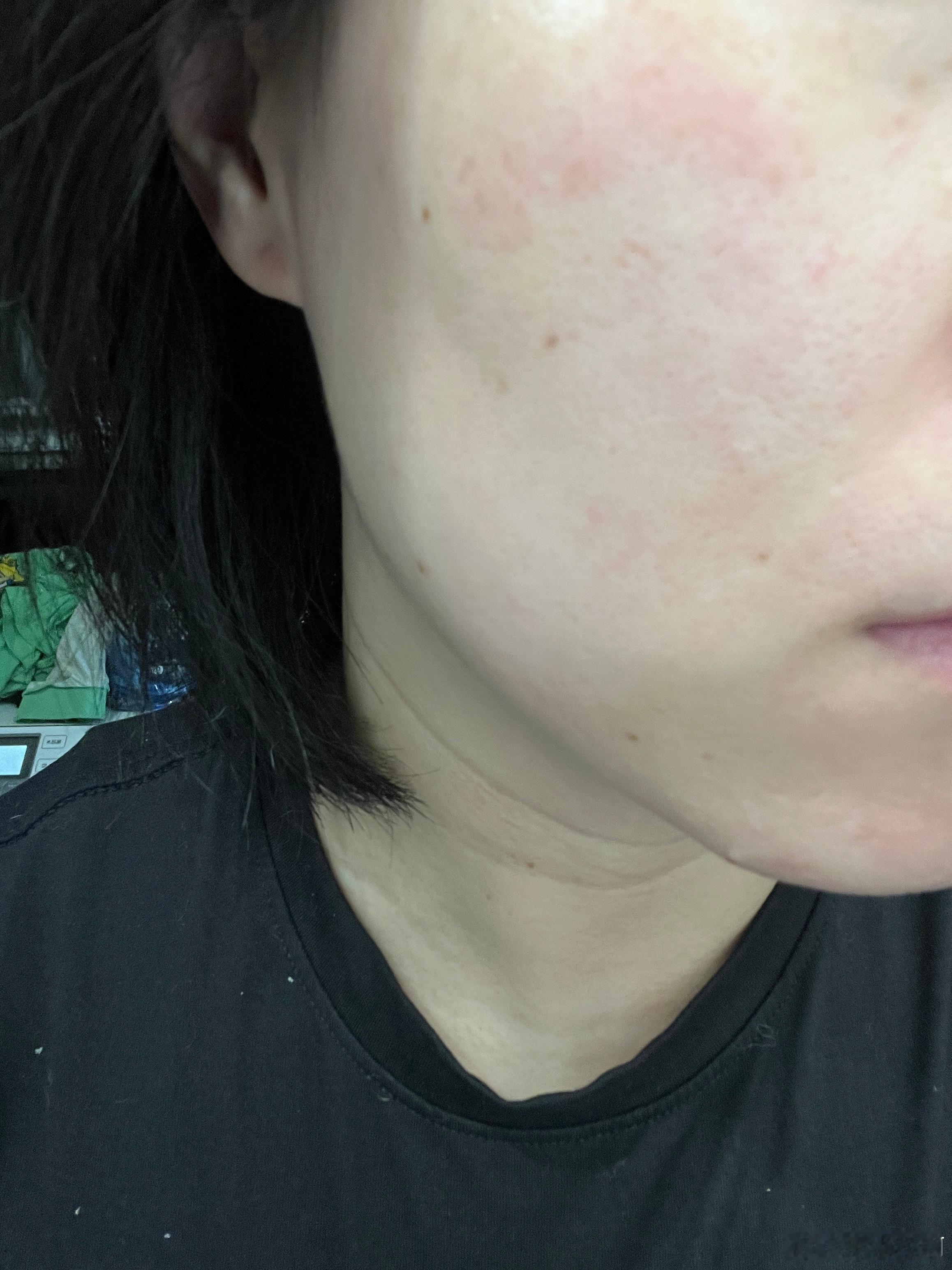 我如果压力大的话，就是两件套1做梦梦见高考2过敏如果不是这样，我就察觉不到 