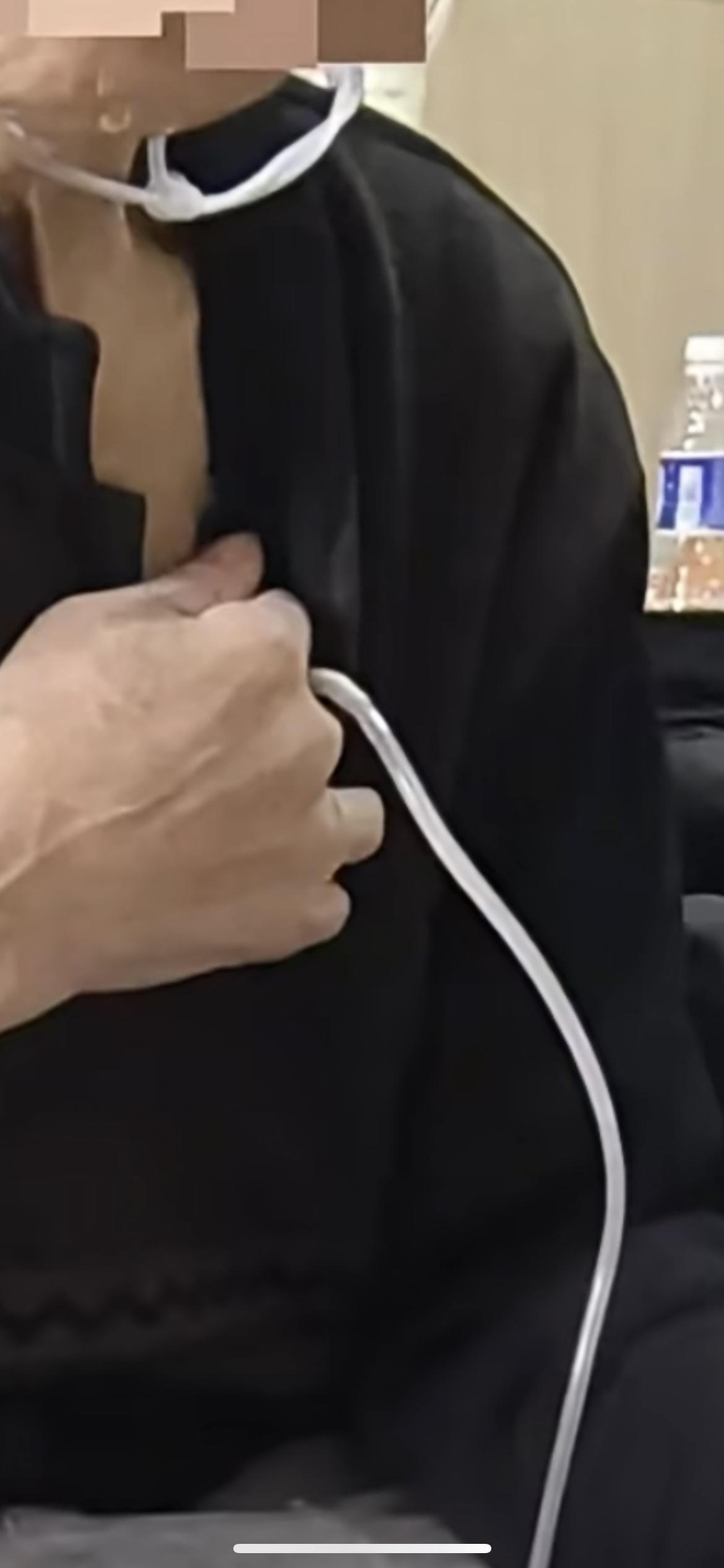 老人气胸呼吸困难，竟自己拿剪刀捅胸，插上“引流管”连接矿泉水瓶“排气”！老人是位