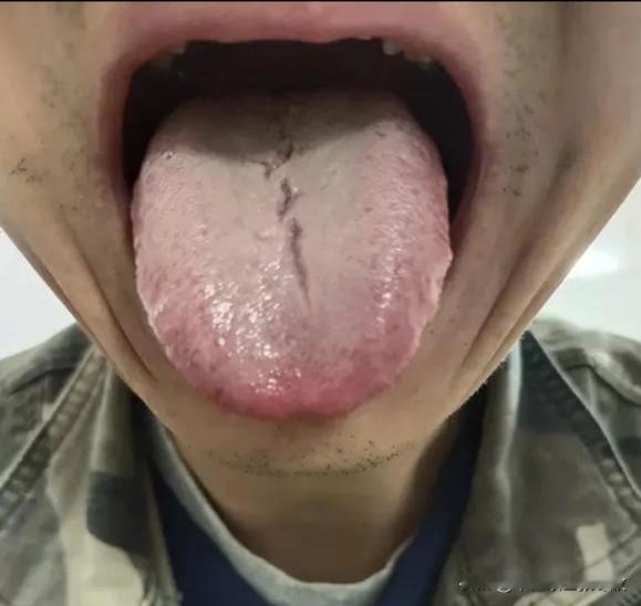 这样的舌头想补肾，我劝你一定注意调理顺序[捂脸][捂脸][捂脸]
粉丝反馈：尿频
