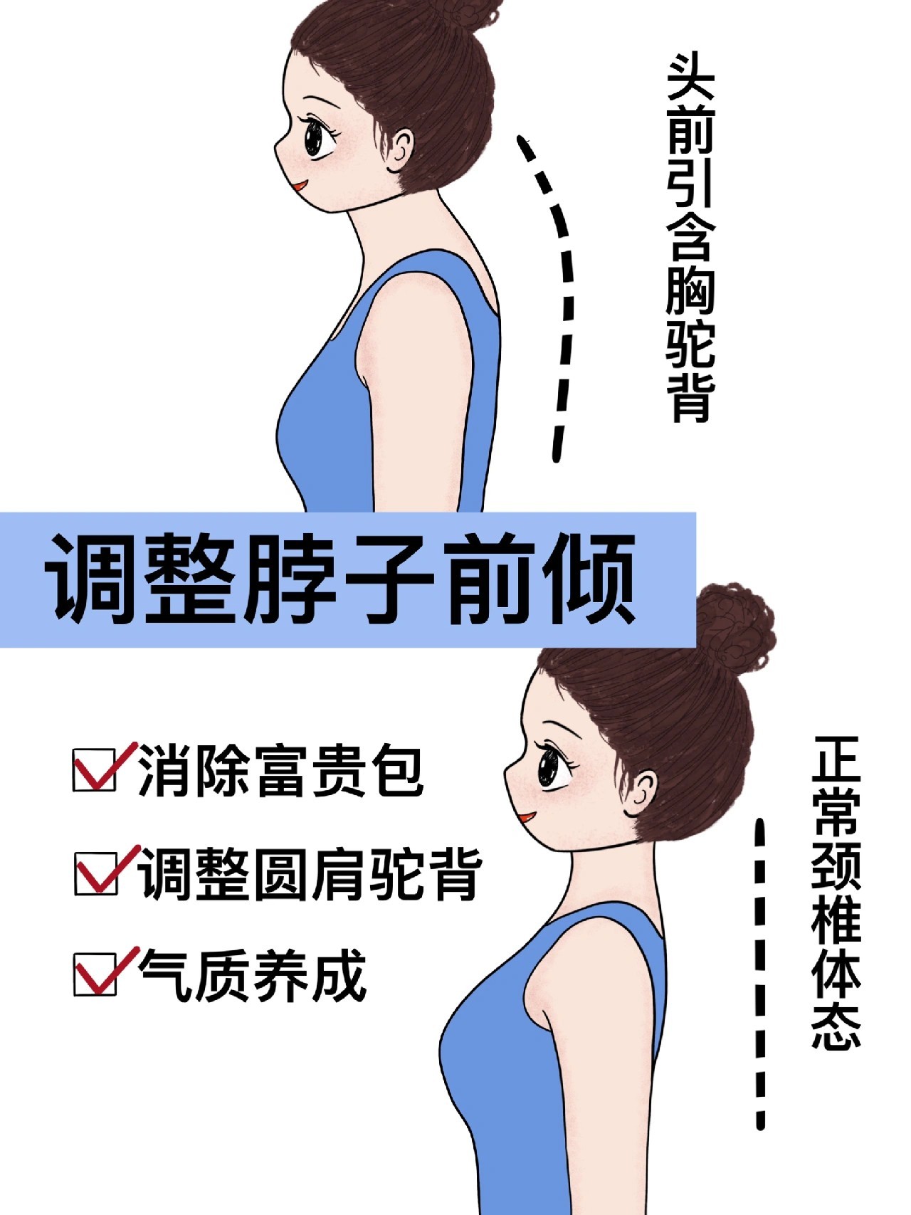 七个动作打造气质肩背，调整脖子前倾富贵包 