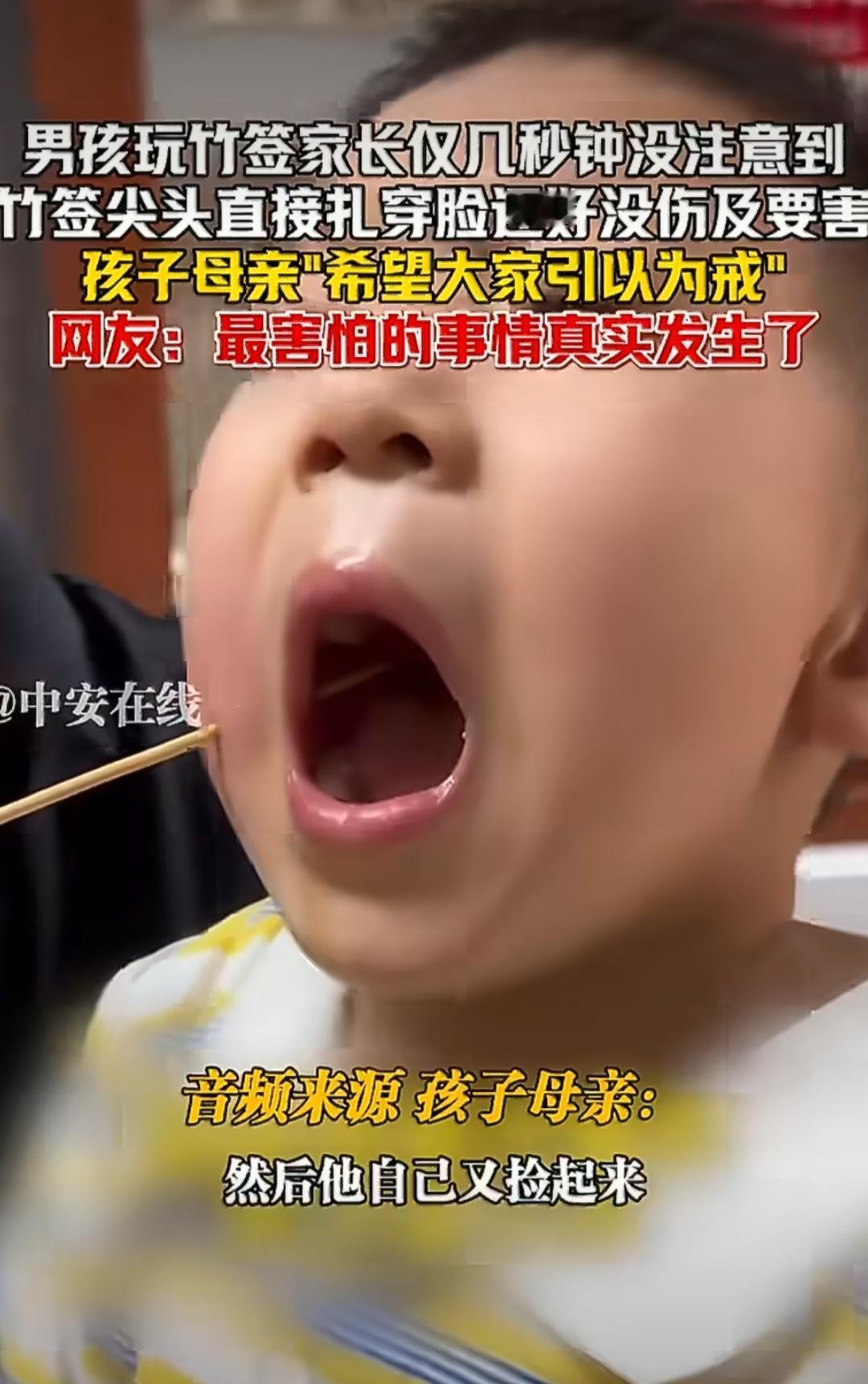 云南一名男孩玩耍时被竹签扎穿脸部的事，让不少家长看得心头一紧，不过万幸的是孩子最