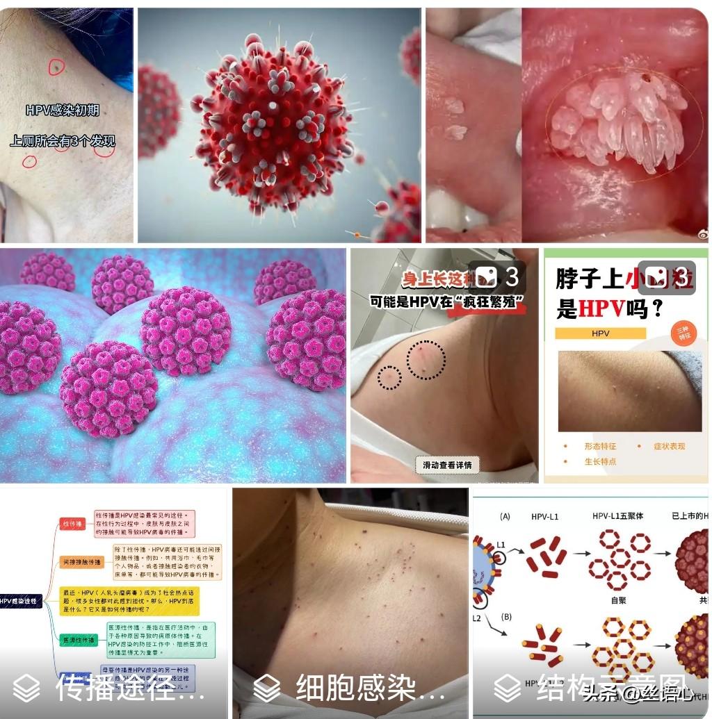 当你老公说他下体长了菜花（hPV感染），是因为出差的时候用抽水马桶传染的，你相信