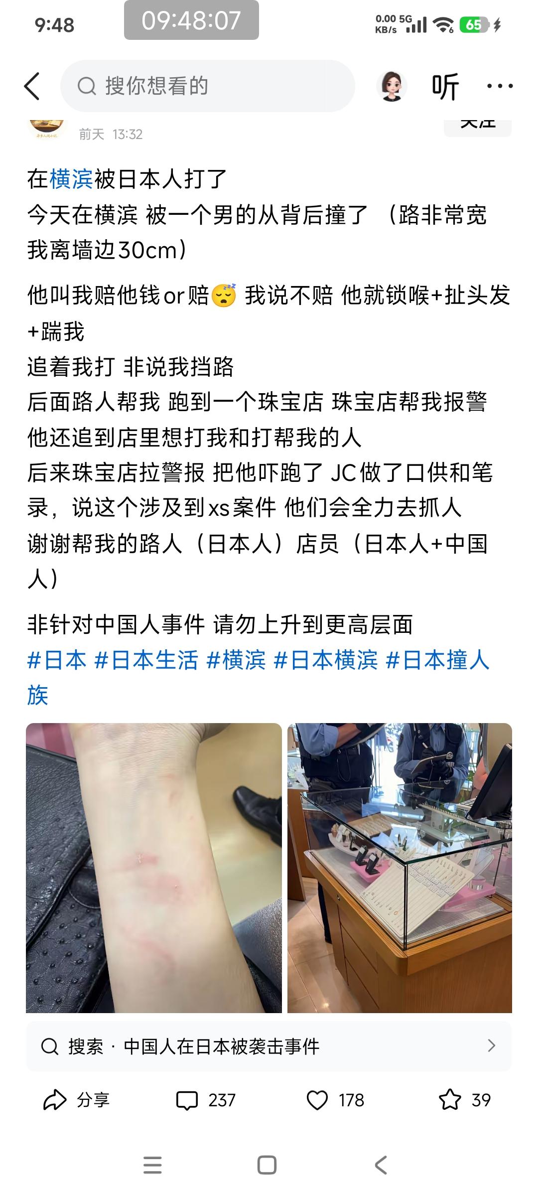 这哥们在日本被日本人打了

就是他正常在路上走，有一个日本人故意去撞他，然后要他